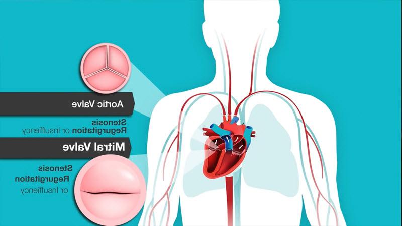了解心脏杂音，主动脉瓣和二尖瓣问题视频截图